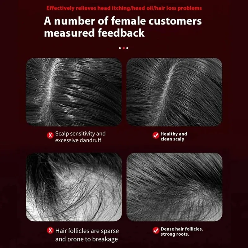 Электрическая вибрационная мас – обзор и цена Hair Care Oil